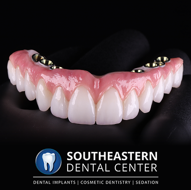 Hybrid Implant Bridge
